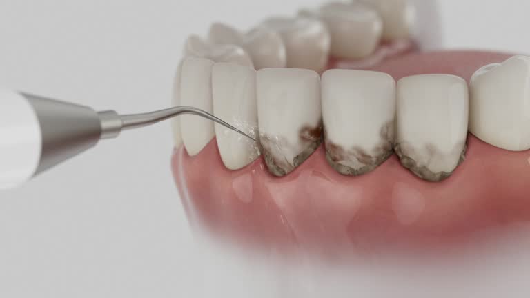 Trusted Teeth Whitening service in Gillett, WI - Dentist Open Now